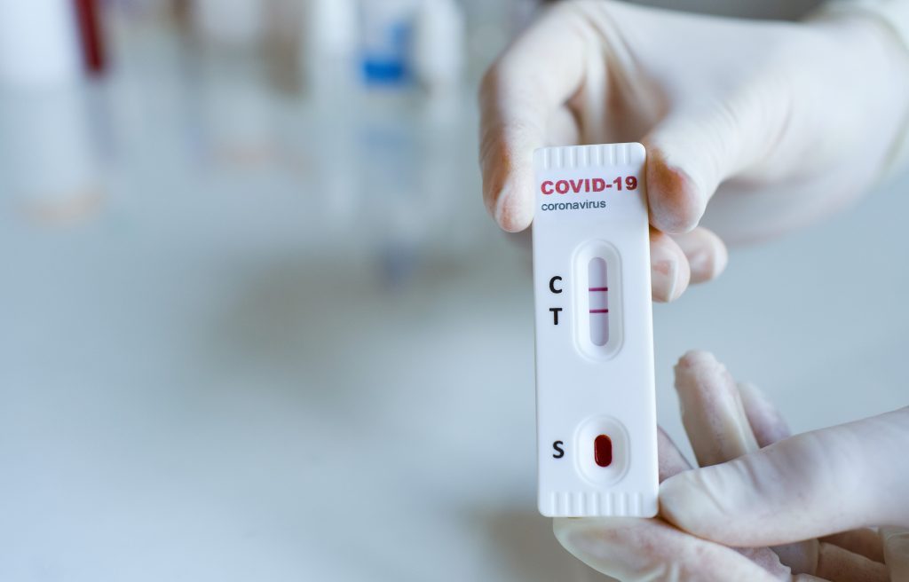 RT-PCR Test