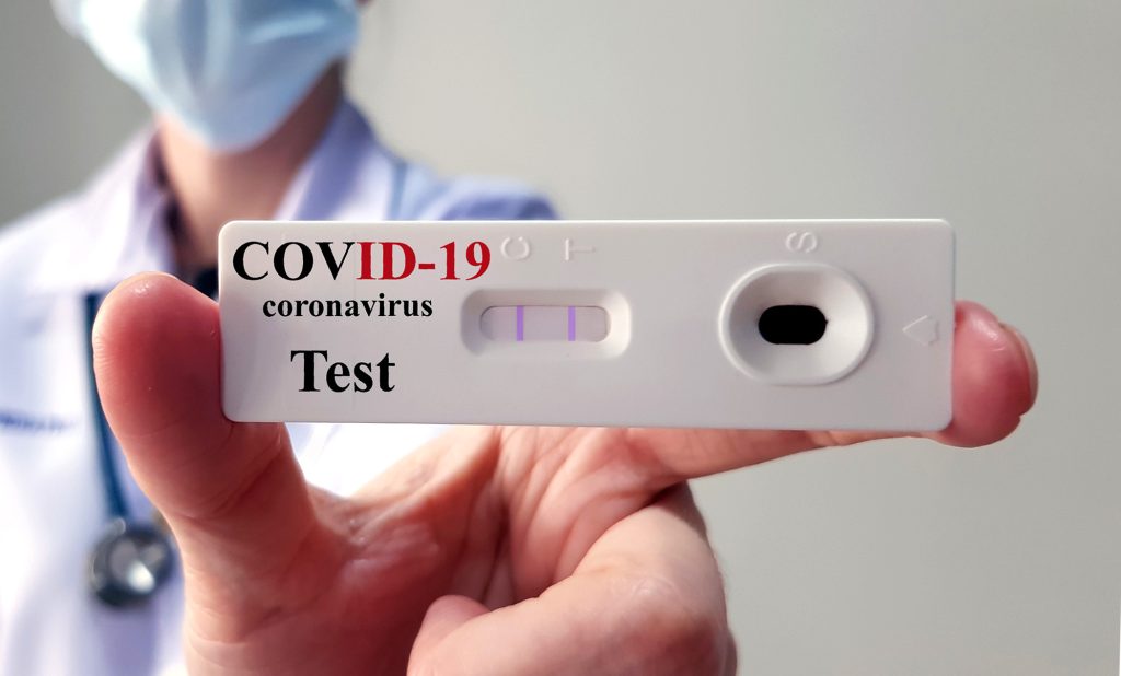 COVID-19 PCR Test