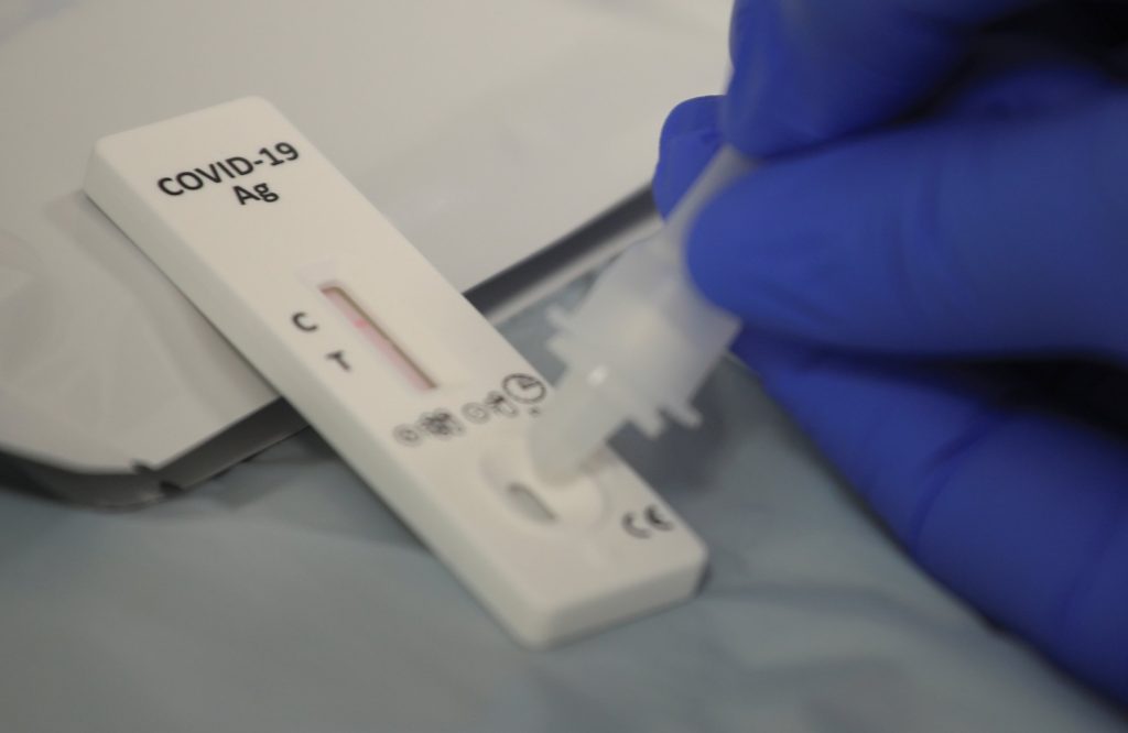 RT-PCR Test