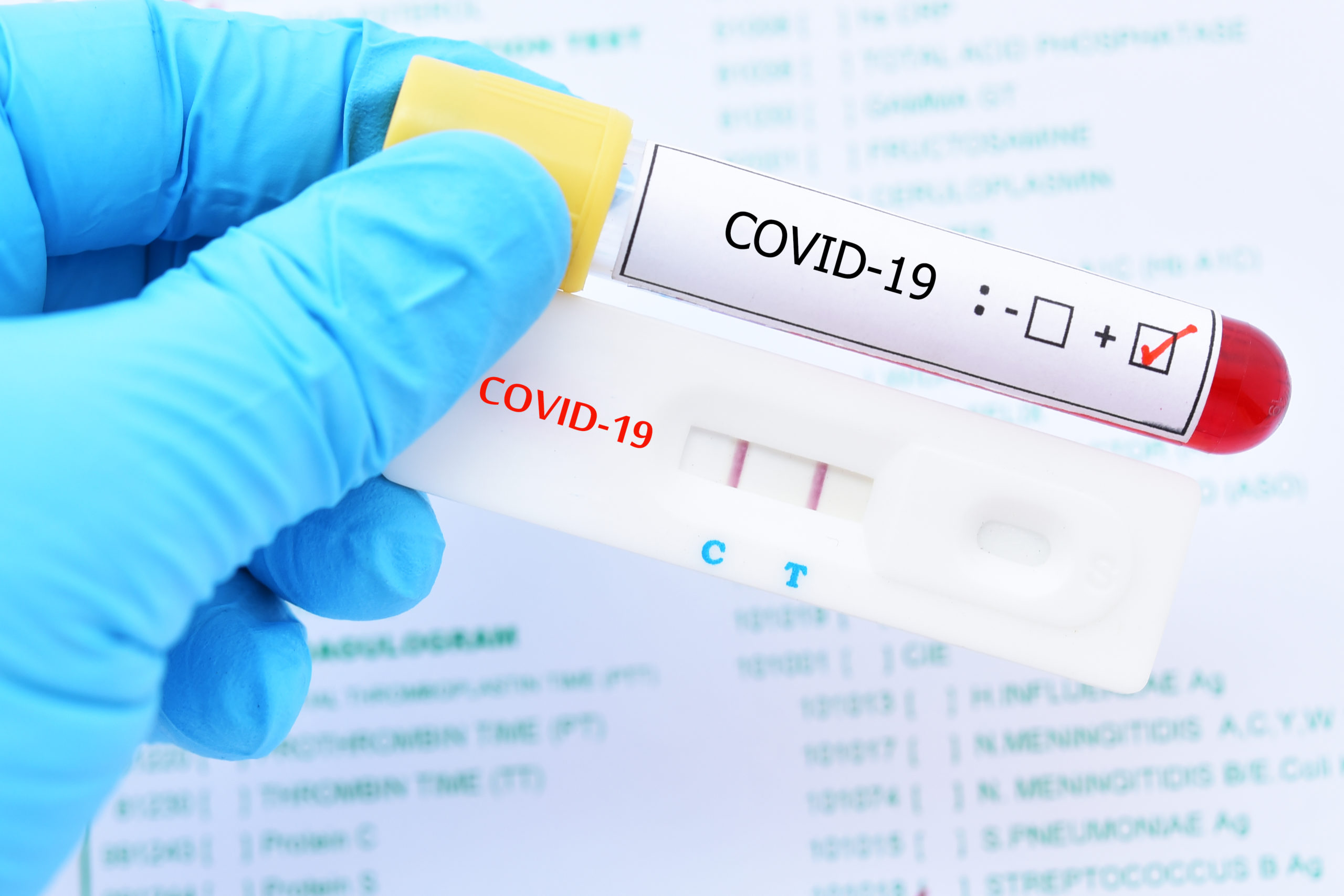 COVID-19 PCR Test